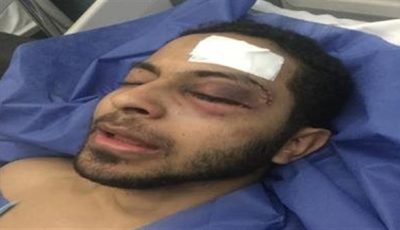 حكم رادع للمتهم بالتعدي على صديقه وإصابته بعاهة مستديمة في القليوبية